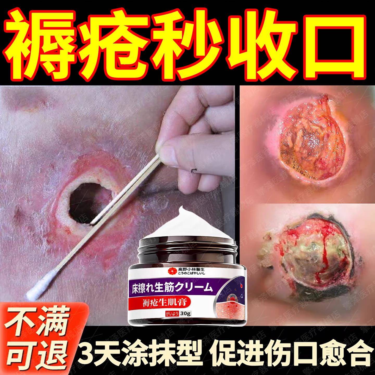 褥疮膏促进伤口长肉压疮卧床瘫痪老人臀部溃烂外用愈合伤口生肌膏