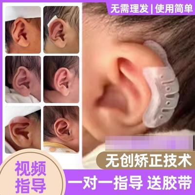 婴儿耳廓矫正器宝宝耳朵纠正器新生儿耳畸形矫形垂耳招风耳塑形固