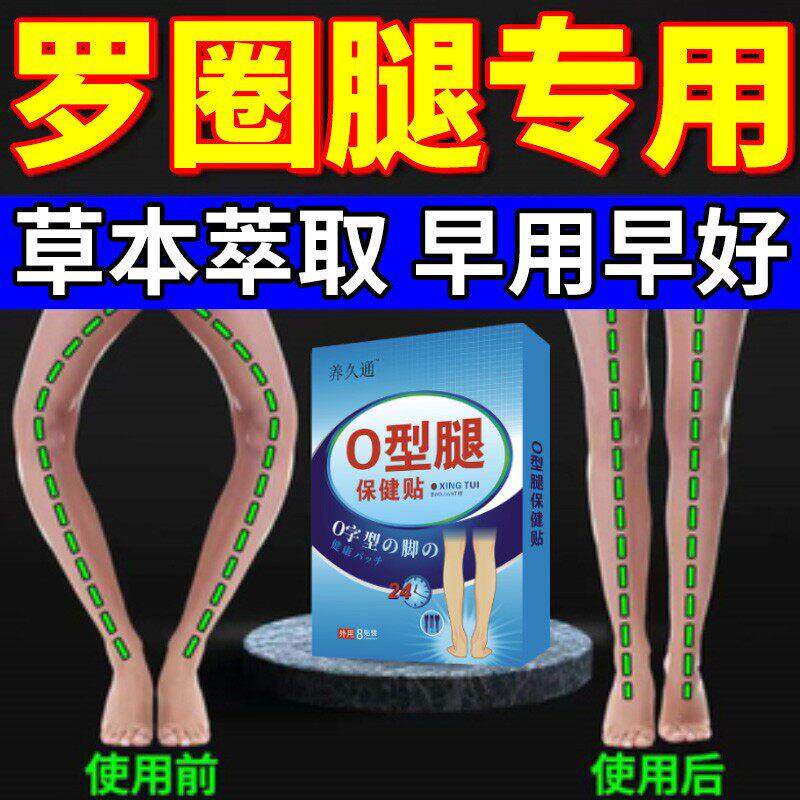 o型腿填充变直改善X型腿罗圈腿内翻内八外八矫正器纠正贴男女通用
