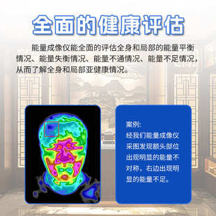 ct堵可视化理疗淤拍成像仪应热感养生寒湿检查红外热体检能量艾灸