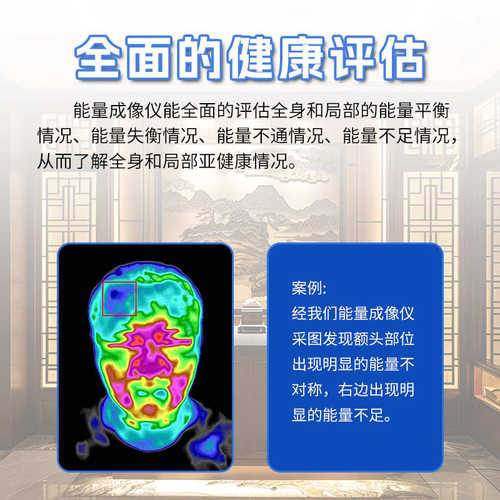 寒湿淤堵拍CT红外热成像仪能量可视化检查艾灸养生体检热感应理疗