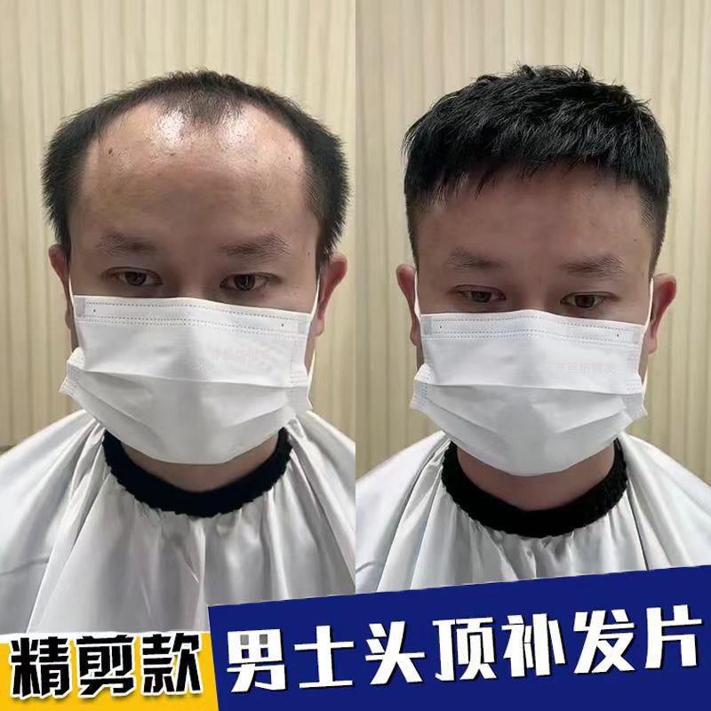 假发男短发头顶补发片无痕隐形真发光头秃顶帅气超薄短发男士补发