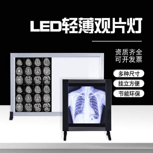 医学影像灯X光观片灯LED灯箱骨科单三联手术CT胶片阅片灯四联调光