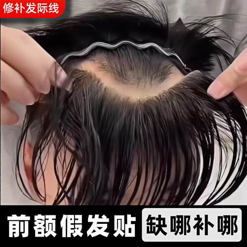 男士发际线假发贴前额补发片M型补额角刘海真发生物头皮透气逼真