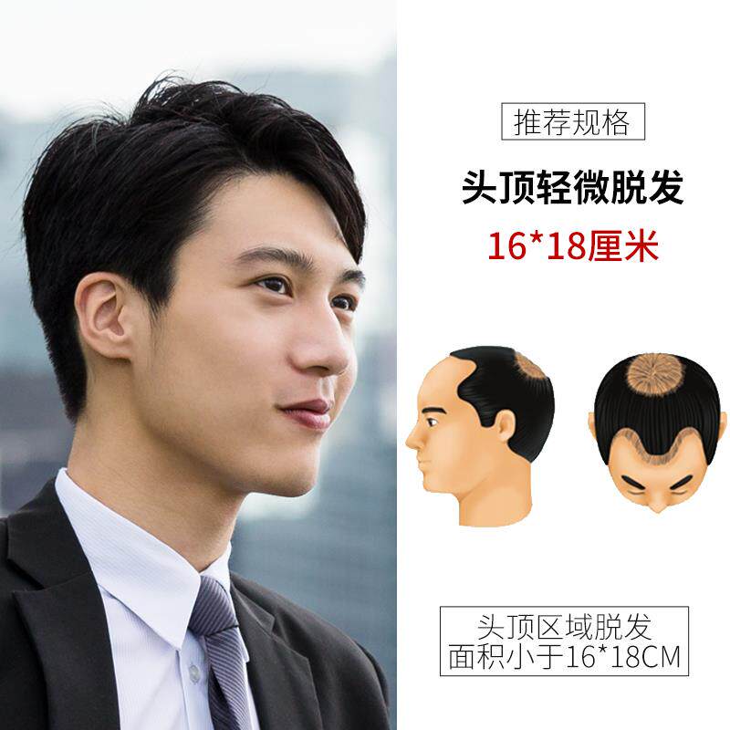 高档男士发短发帅气韩男版头顶中补假发片偏分秃顶前额老年式真发