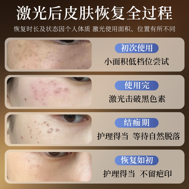精品皮秒激光祛斑仪器点斑消痣洗纹身淡斑家用无痛洗眉美容院专用