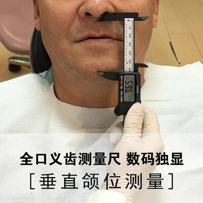 牙科全口义齿测量尺垂直颌位口腔数显游标卡尺上海医疗面部咬合型