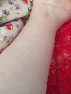 康佳激光脱毛仪有用吗?康佳激光脱毛仪怎么样?真管用?