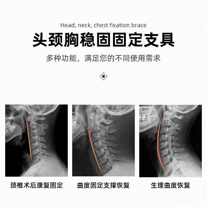 供应头颈胸固定支具成人可调歪脖子矫形器康复颈托