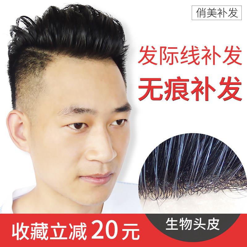 假发男韩版帅气头顶补发片男无痕隐形假发片前额真发际线 线生物