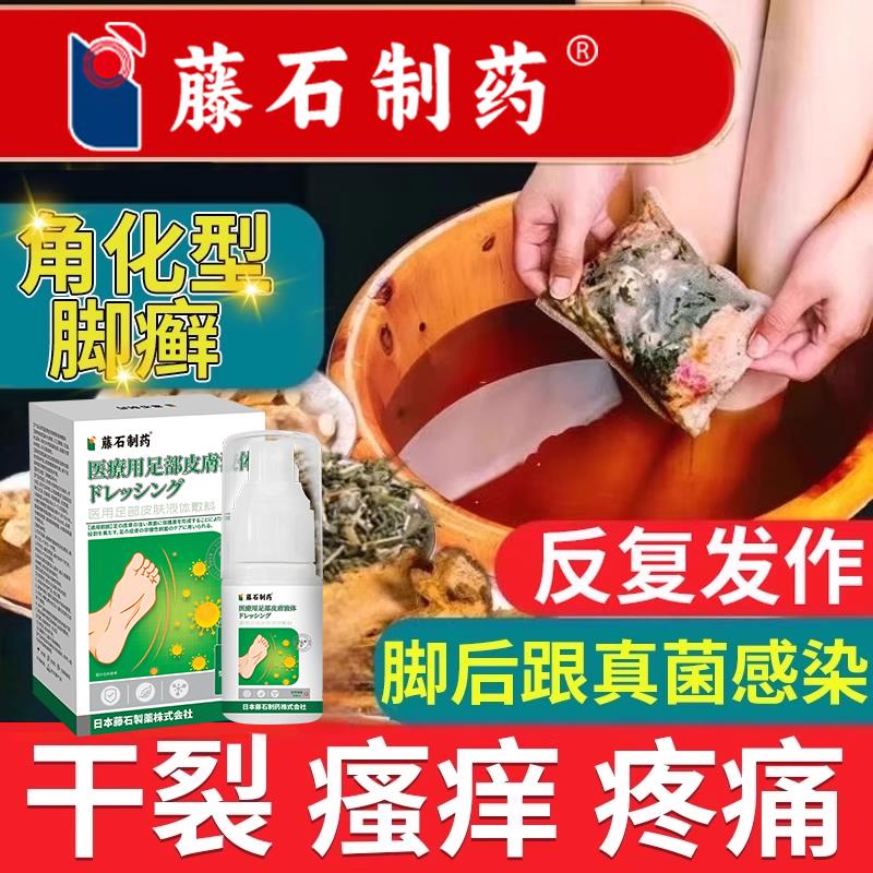 角化型脚癣去真菌脚气泡脚药房同售包脚后跟止痒脱皮真感染j菌s医