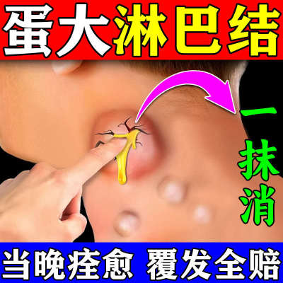 淋巴结特效药消散膏消除脖子颈部腋下淋巴结肿大散结贴膏消炎药膏
