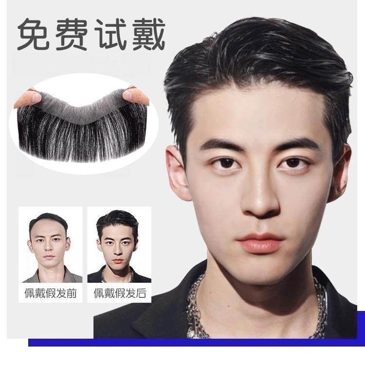 发际线假发贴男士假发片隐形无痕贴片真发M型前额补发片刘海片男