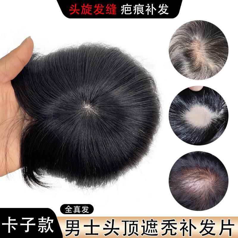 假发片男全真人发头旋发缝遮盖伤疤男士补发头顶部稀少脱发补发片