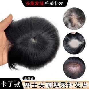 假发片男全真人发头旋发缝遮盖伤疤男士补发头顶部稀少脱发补发片