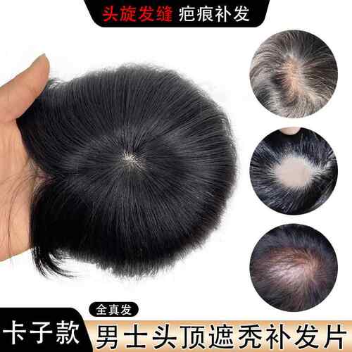 假发片男全真人发头旋发缝遮盖伤疤男士补发头顶部稀少脱发补发片