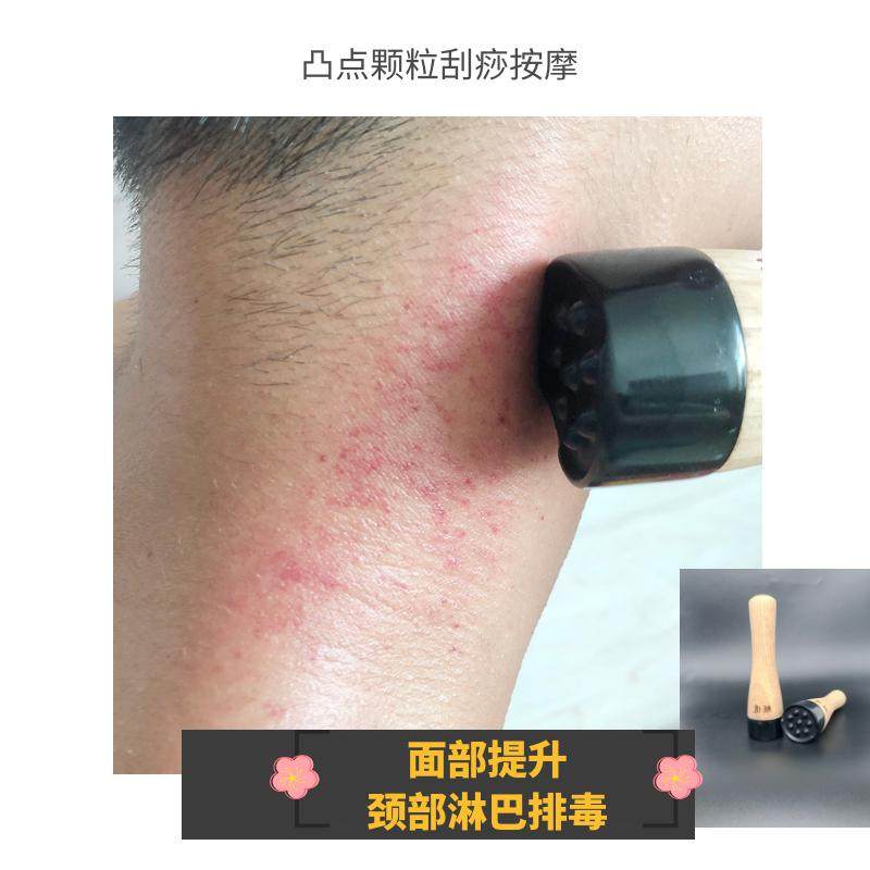 远红外砭石面部眼部美容仪器颈部刮痧家用按摩艾脸部刮痧加热温灸,个人护理/保健/按摩器材,按摩温熏调理器,淘宝优惠券,粉丝福利购,淘宝优惠卷