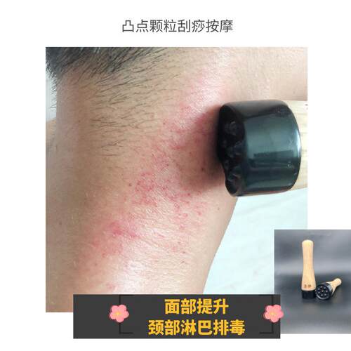 远红外砭石面部眼部美容仪器颈部刮痧家用按摩艾脸部刮痧加热温灸