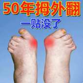 拇指外翻矫正器 治大母脚趾外翻分趾矫正器专用贴YX 万人已矫正