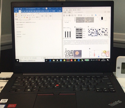 ThinkPad E490 2UCD英特尔酷睿i5怎么样?多少人被坑是真假?