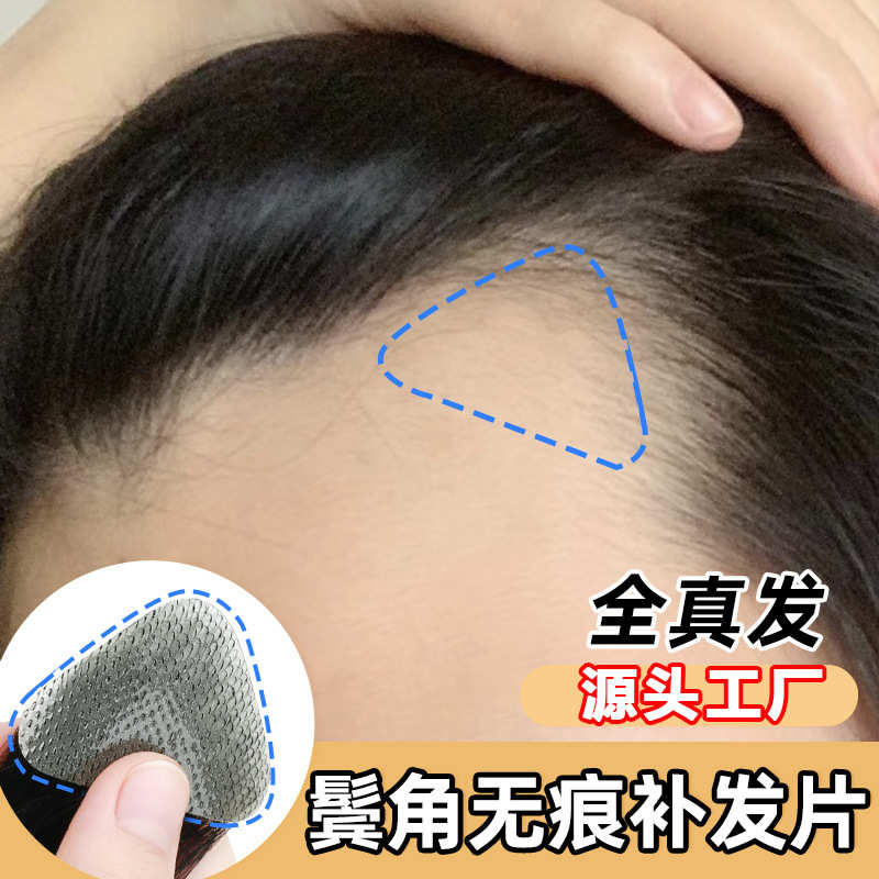 发际线假发贴男女全真发鬓角假发补发片前额遮秃m型发际线补发片