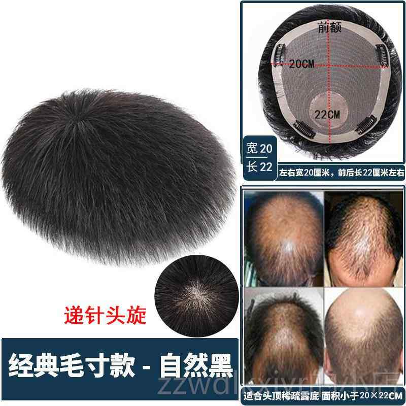 新款补假发男短发毛寸造型全真发假发片自然形无痕轻薄男士头顶发