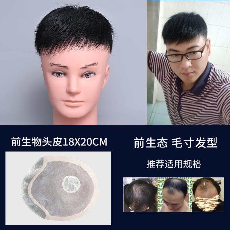 高档织补发假男士头顶短发块真发假中发片秃顶无痕隐发发形前额地