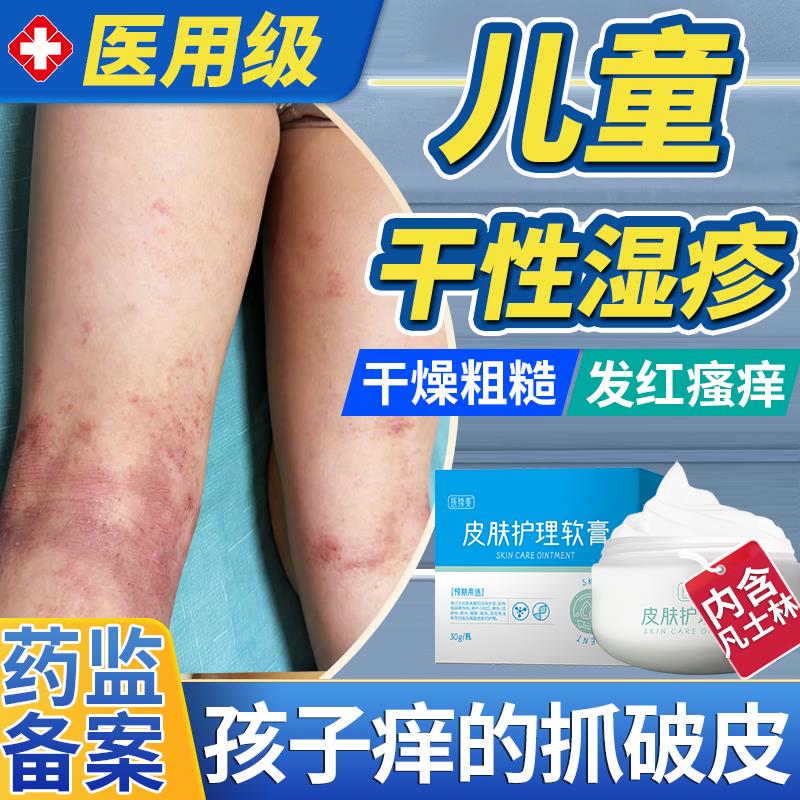 儿童宝宝干性湿疹特应性皮炎专用膏皮肤燥瘙痒止痒保干湿身体乳PG