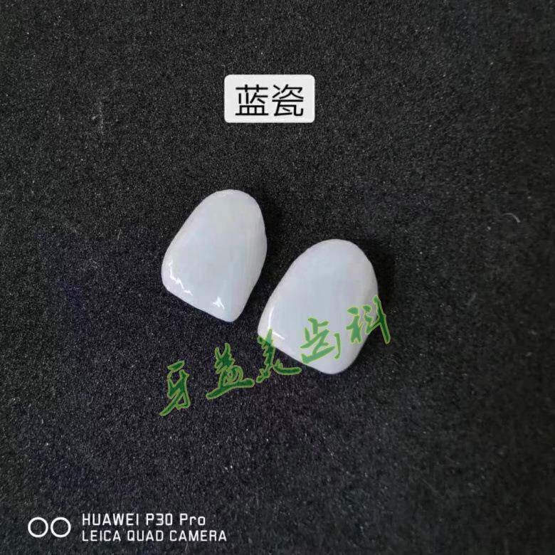 冰瓷牙全瓷贴面蓝瓷 较薄牙贴片牙釉质 贴片厂家直供