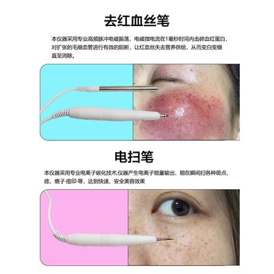 多功能祛斑去红血丝阻断仪器点痣疣高原红大红脸扫斑红血丝美容仪