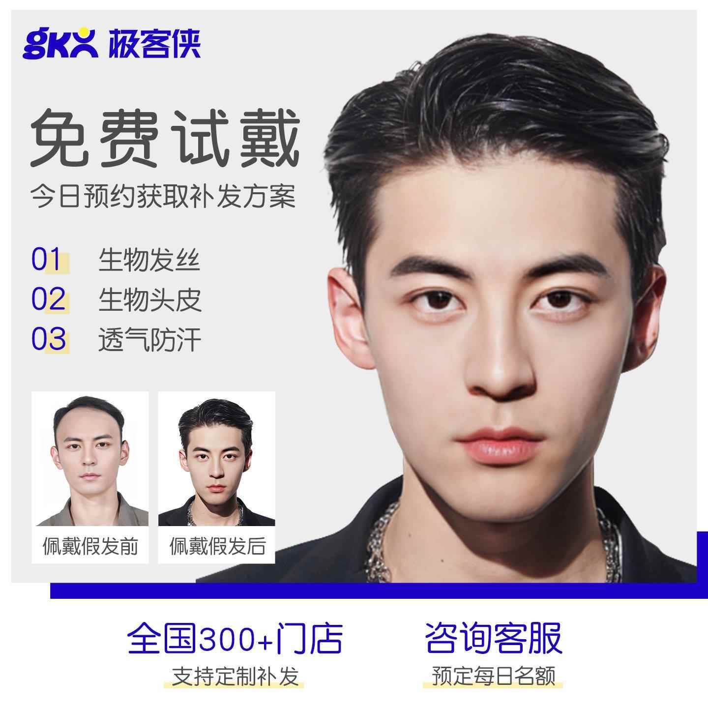 极客补发假发定制秃顶假发头顶补发片假发男补发