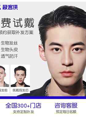极客补发假发定制秃顶假发头顶补发片假发男补发