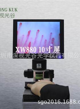 厂家直供 高清微循环观测仪XW880 专业检测甲壁血流 无创伤检测