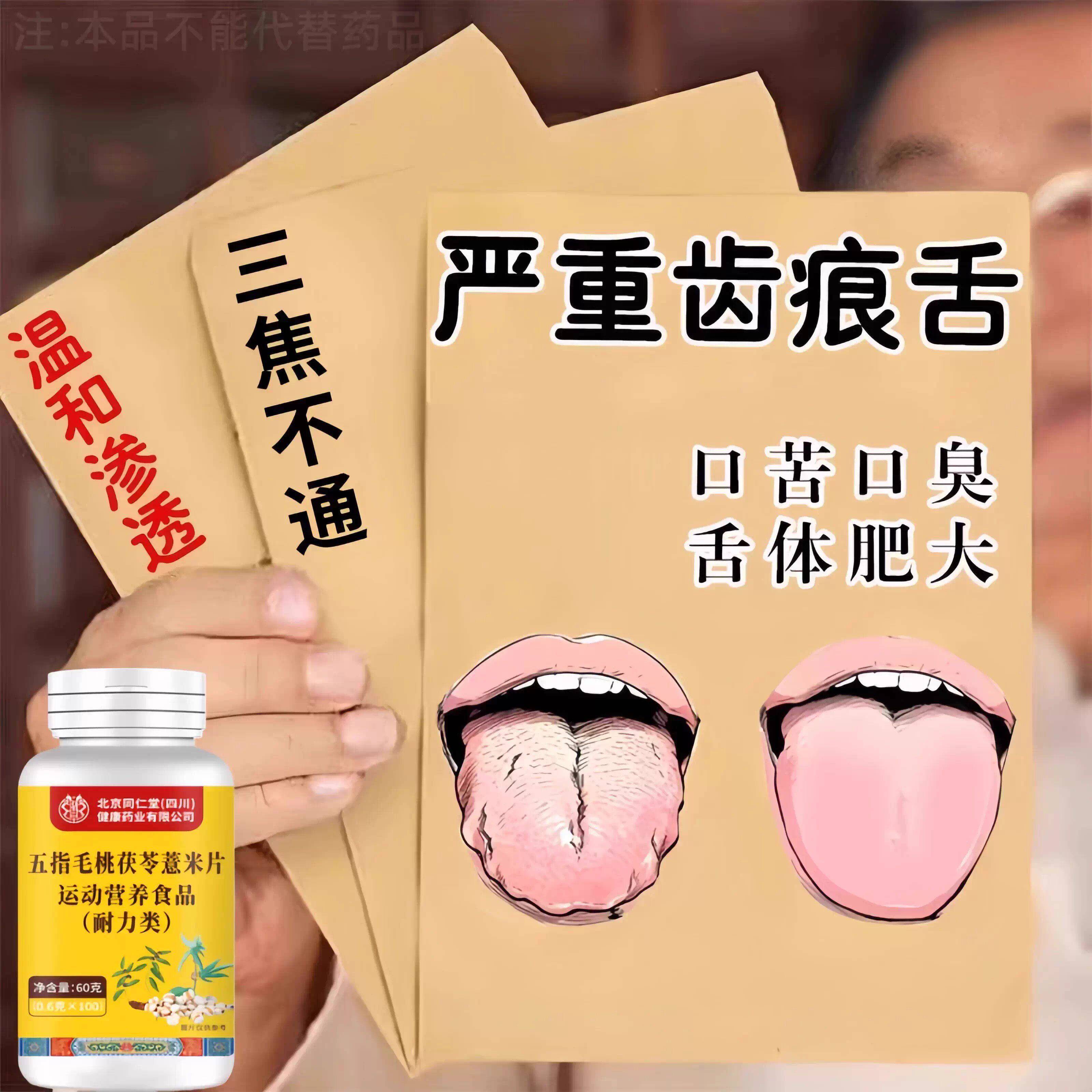 三焦不通齿痕舌舌苔白厚舌头有裂纹舌体胖嫩湿气重口臭