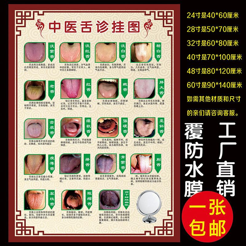中医舌诊挂图海报美容院海报图挂图宣传画墙画养生会所展板装饰画
