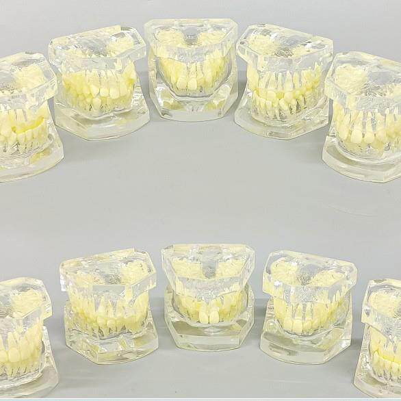 错颌分类模型牙齿正畸模型正畸展示模型牙模型