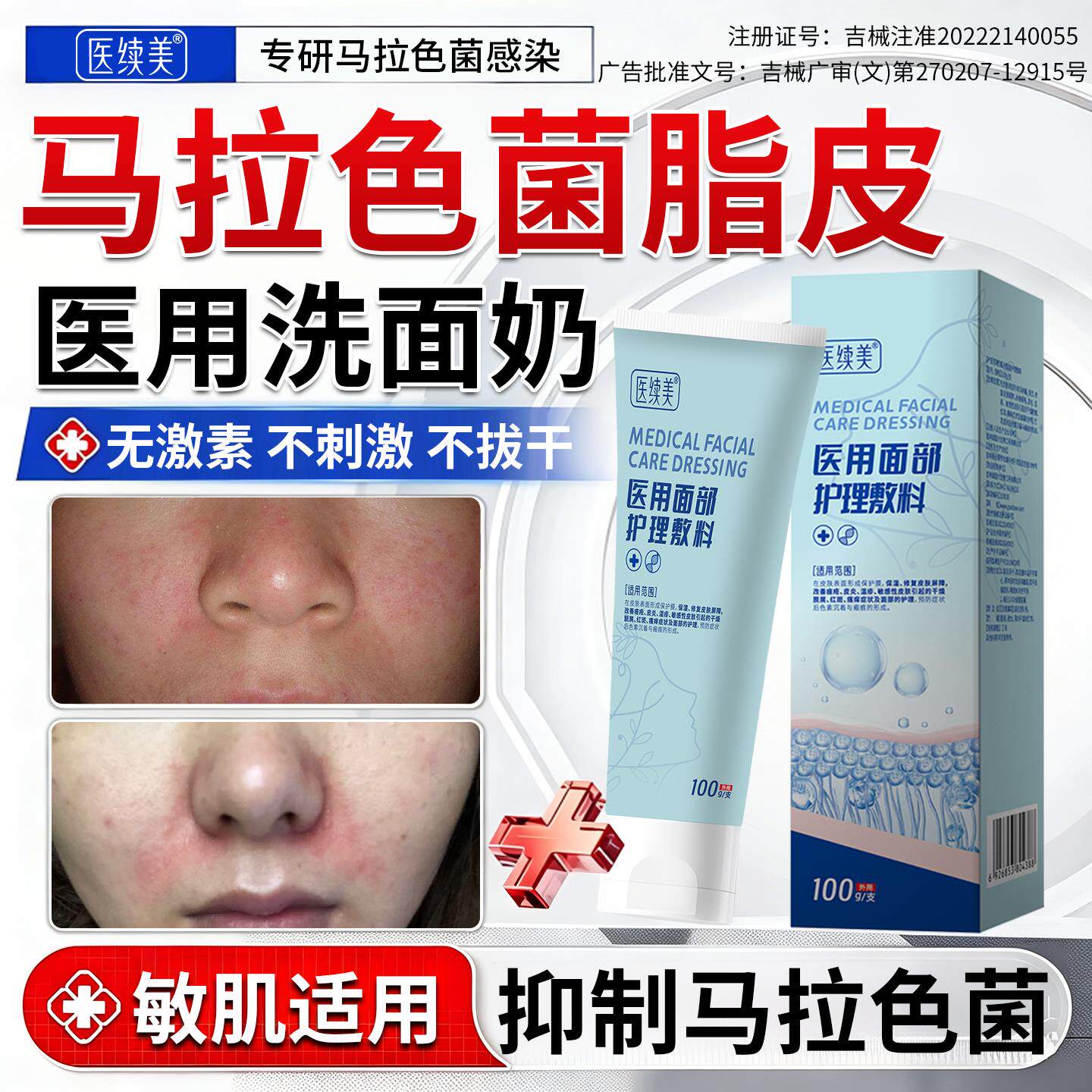 马拉色菌脂溢性皮炎洗面奶面部修复护肤品用医清洁抗菌控油祛痘RW