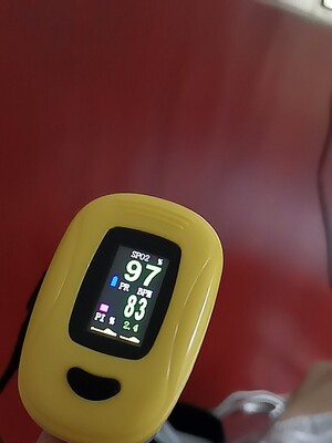 实情诉说科司德制氧机怎么样揭秘用后感受