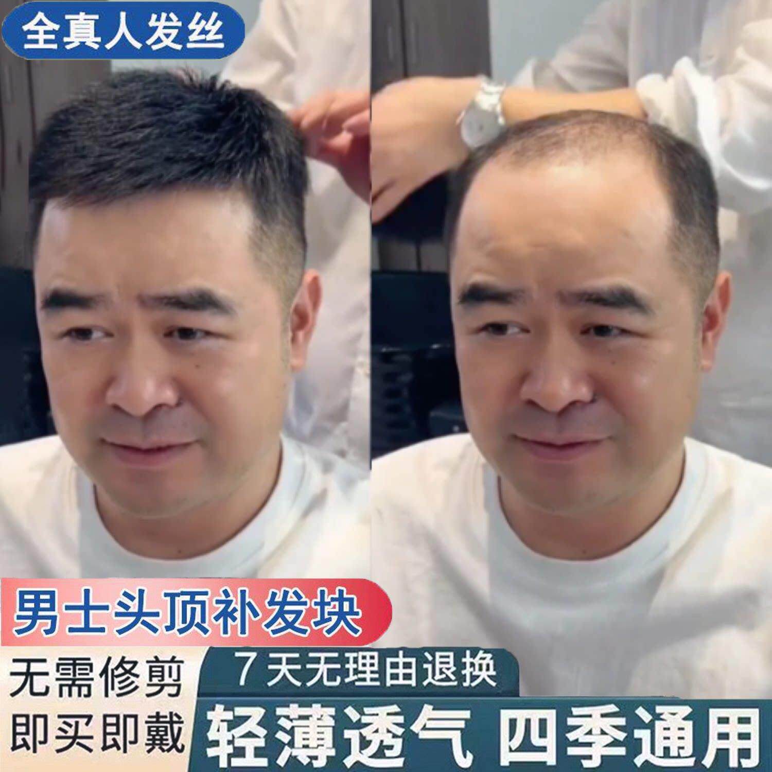 假发男短发帅气真人发丝毛寸男士假发隐形无痕头顶补发片男假发片