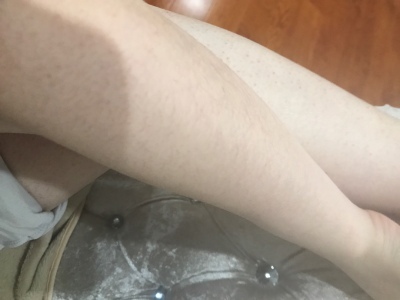 蒂丝脱毛仪怎么样?用我的使用经历告诉大家真相