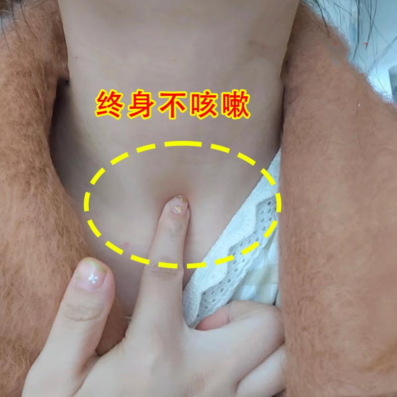 【50倍】贴特效咳嗽化痰神器小儿成人平喘JY