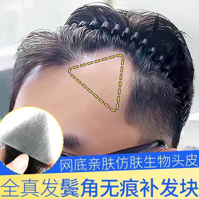 鬓角假发男女通用全真人发前额m型发际线无痕男士浏海片补发贴片