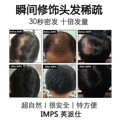 IMPS发发线填充浓密增多美发补发神器密增发假发粉发头少际MKP纤