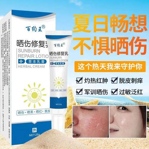 百约王晒伤修复乳晒伤膏晒后修复防紫外线日光性皮炎脸部脱皮刺痒
