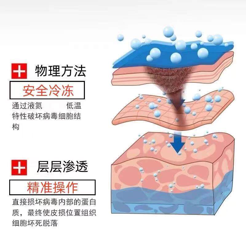 羲用液993氮冷降温液态氮冷冻家液氮喷雾小瓶装方便玥冻降温多用