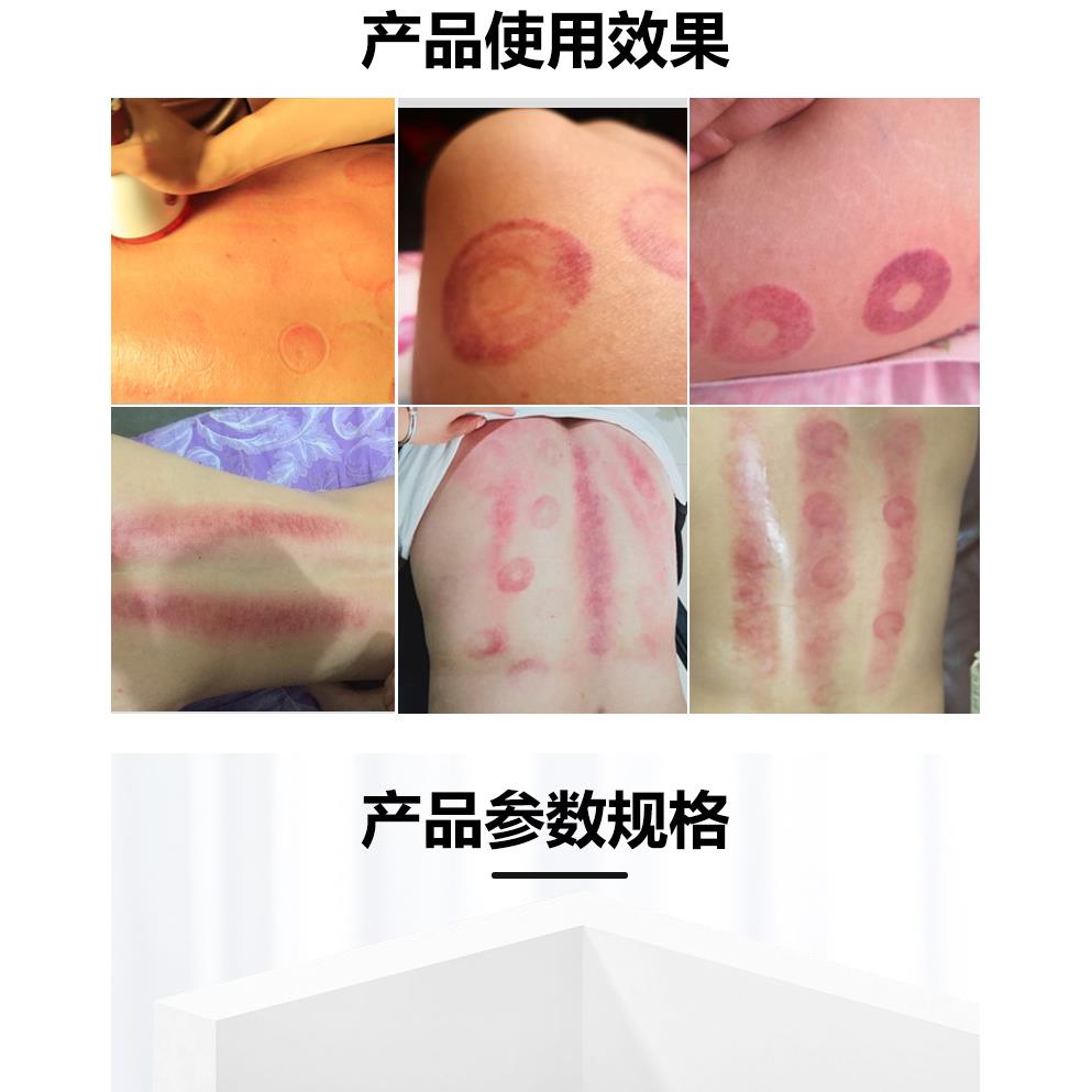 新款直销充电款砭石温灸仪便携经络刮痧仪热敷推拿通络按摩器拔罐