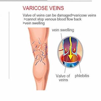 Varicose Ve Compression Socks Fit For Golf Rugby Hiking Spor