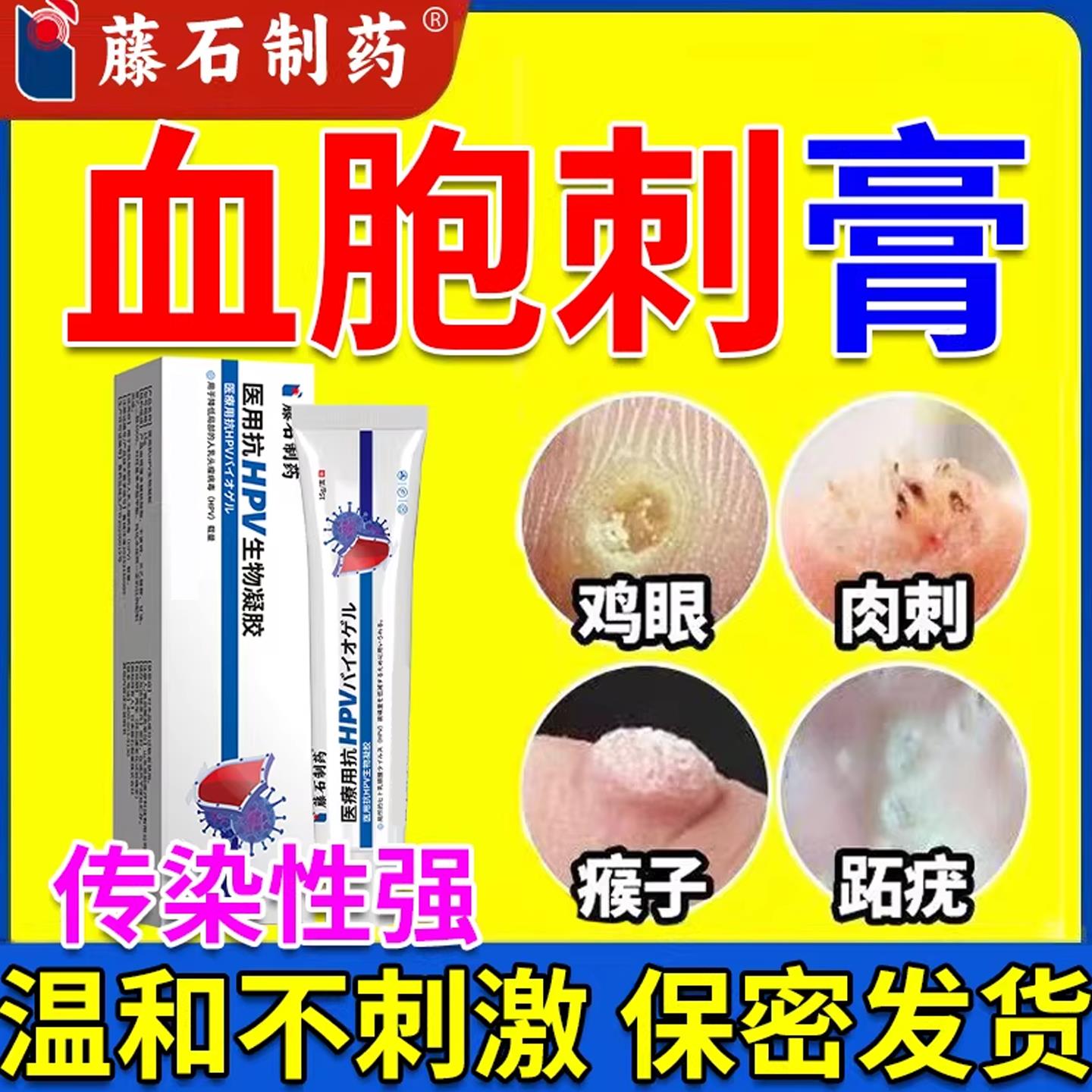 血胞疣刺脚底鸡眼跖拓疣趾硬疙肉刺猴子茧血包刺寻常疣瘊去除膏ZF