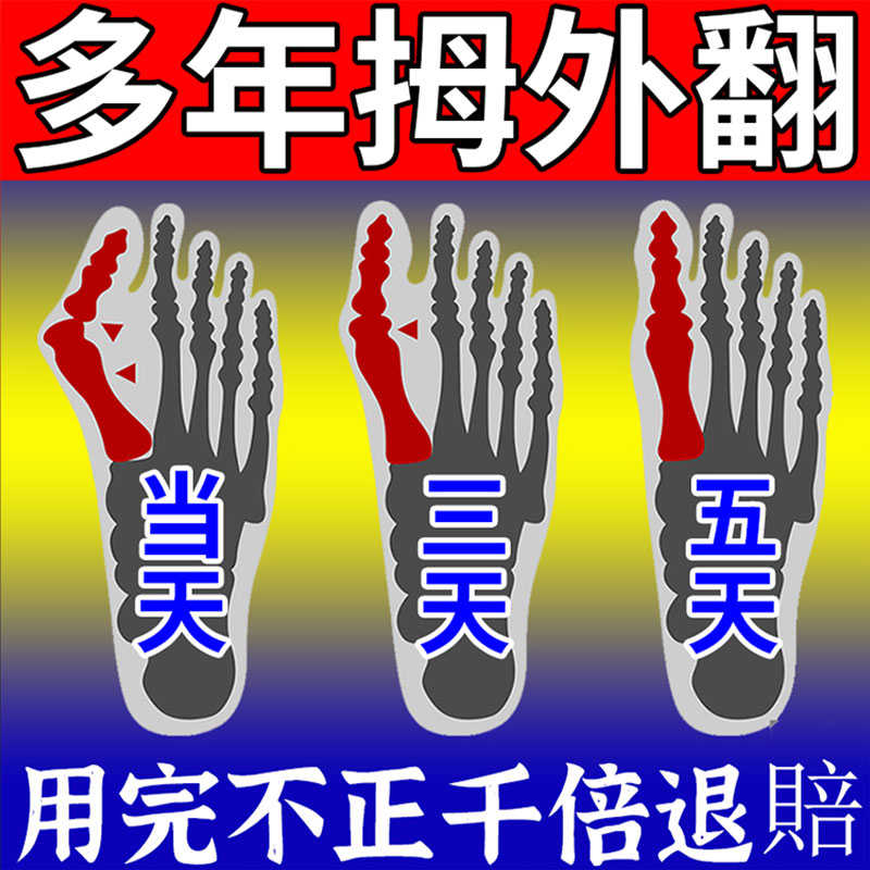 拇指外翻中药贴升级版【快速止痛】大脚骨畸形矫正贴防磨脚足神器
