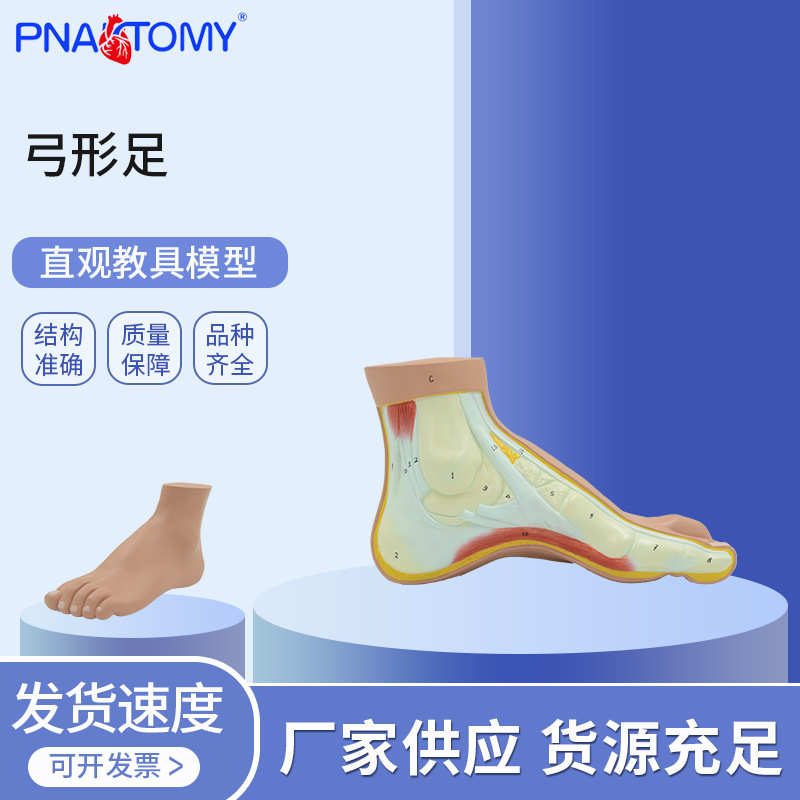 PNT-0727 弓形足 模型 足部病理模型人体足部解剖模型脚关节